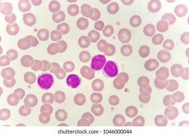 Human Red Blood Cell Ovalocyte Stock Photo (Edit Now) 767603218