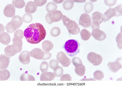 White Blood Cells Blood Smear Analyze Stock Photo 1094072609 | Shutterstock