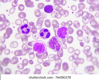 White Blood Cells In Blood Smear, Analyze By Microscope