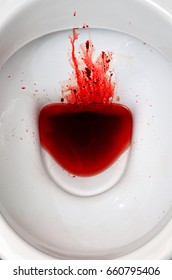 98 Bloody stool Images, Stock Photos & Vectors | Shutterstock