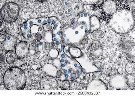 White coronavirus under a Microscope.