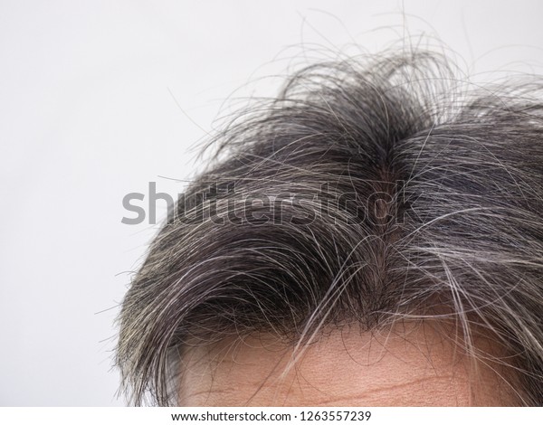 White Hair Hair Hair Loss Baldnesshair Stock Photo Edit Now