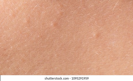 斑点 白い 腕 に 白斑とは皮膚の色素が抜ける疾患 原因や症状、治療法について詳しく解説