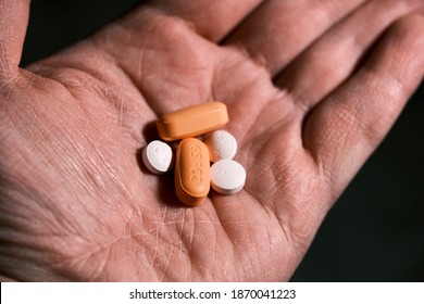 White And Orange Antiretroviral Therapy Pills For Treatment Of HIV In Hand. Dolutegravir, Abacavir, Lamivudine. World AIDS Day Concept. Healthcare And Medicine. Tablets And Medication. HAART.