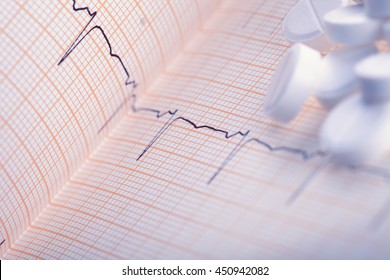 White Pills On The ECG Paper.