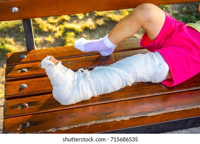 White Skin Kid Broken Left Leg Stock Photo 715686535 | Shutterstock