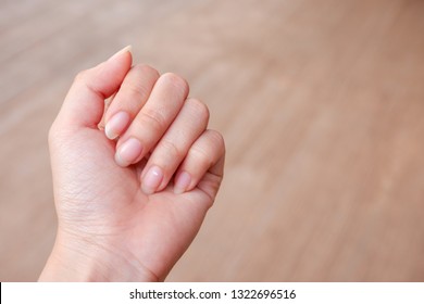 82 Nail Diseases Infants Images, Stock Photos & Vectors | Shutterstock