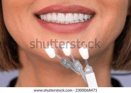 Whitening concept. Dental care, implants for veneers. Beautiful caucasian woman with perfect smile chooses tooth tone in dental clinic. Modern medicine.