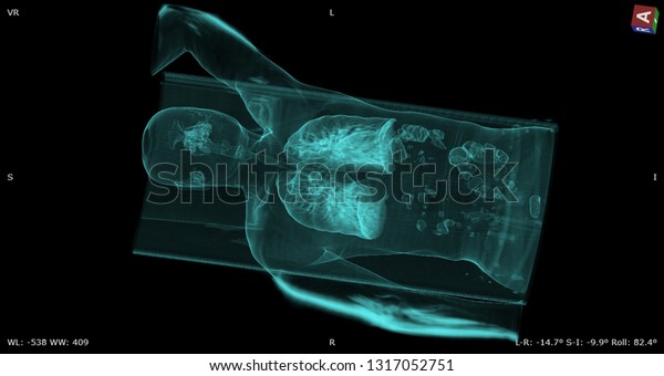 Whole Body Computed Tomography Human Ct Stock Photo Edit - 