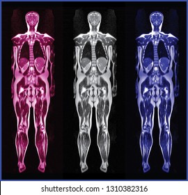 Whole Body MRI Scan Of Normal Human Body (High Resolution)