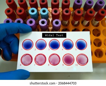 Widal Test By Agglutination Method At Plate Isolated On White Background. To Diagnosis Typhoid And Paratyphoid Fever At Medical Laboratory. Salmonella Bacteria Disease Testing