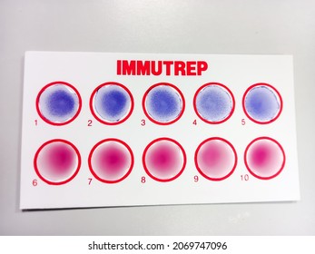 Widal Test By Agglutination Method At Plate Isolated On White Background, To Diagnosis Typhoid And Paratyphoid Fever At Laboratory, Salmonella Bacteria Disease Testing