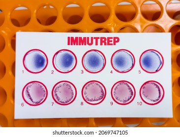 Widal Test By Agglutination Method At Plate Isolated On White Background, To Diagnosis Typhoid And Paratyphoid Fever At Laboratory, Salmonella Bacteria Disease Testing