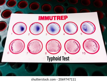 Widal Test By Agglutination Method At Plate Isolated On White Background, To Diagnosis Typhoid And Paratyphoid Fever At Laboratory, Salmonella Bacteria Disease Testing