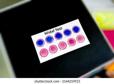 Widal Test By Agglutination Method At Plate Isolated On Black Background. To Diagnosis Typhoid And Paratyphoid Fever At Medical Laboratory. Salmonella Bacteria Disease Testing