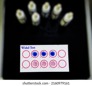 Widal Test By Agglutination Method At Plate Isolated On Black Background, To Diagnosis Typhoid And Paratyphoid Fever At Laboratory, Salmonella Bacteria Disease Testing