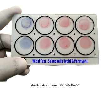 Widal test by agglutination method with white background. To diagnosis Typhoid and Paratyphoid fever at laboratory