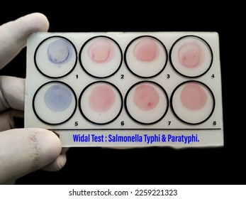 Widal test by agglutination method with black background. To diagnosis Typhoid and Paratyphoid fever at laboratory