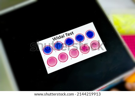 Widal test by agglutination method at plate isolated on black background. To diagnosis Typhoid and Paratyphoid fever at medical laboratory. Salmonella bacteria disease testing