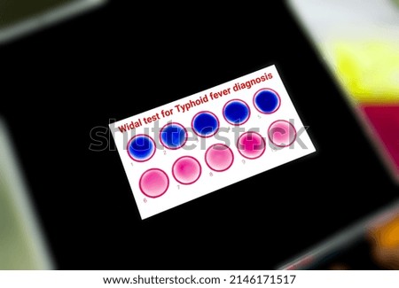 Widal test by agglutination method at plate isolated on black background. To diagnosis Typhoid and Paratyphoid fever