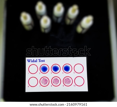 Widal test by agglutination method at plate isolated on black background, to diagnosis Typhoid and Paratyphoid fever at laboratory, Salmonella bacteria disease testing