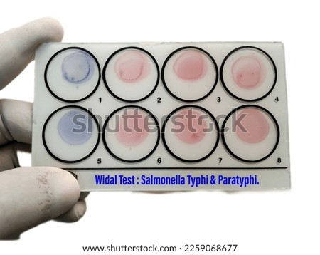 Widal test by agglutination method with white background. To diagnosis Typhoid and Paratyphoid fever at laboratory