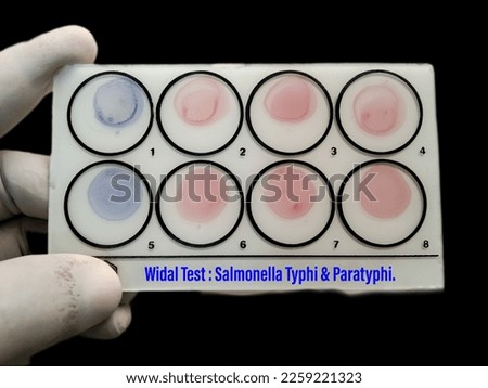 Widal test by agglutination method with black background. To diagnosis Typhoid and Paratyphoid fever at laboratory