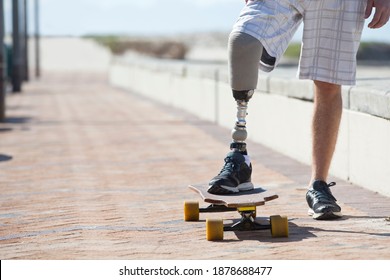 Wide shot of the prosthetic leg of a man resting on a skateboard - Powered by Shutterstock