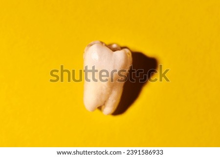 Wisdom tooth with tooth decay, yellow background. Removed third molar affected by caries. Dental extractions.