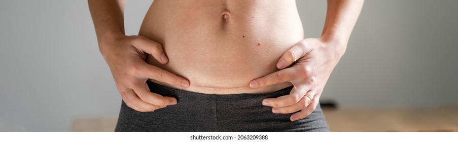 Woman abdomen with cesarean scar. Home candid lifestyle. C section surgery for pregnant woman. Recovering after birth.  - Shutterstock ID 2063209388