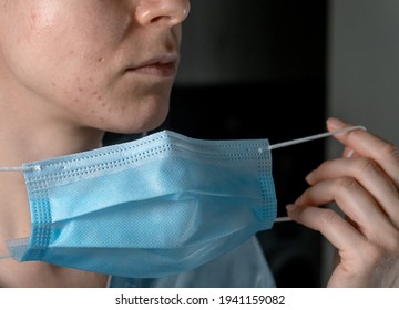 Woman With Acne And Irritation From Wearing A Mask. 