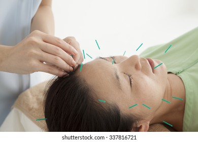 Woman to the acupuncture treatment at the salon