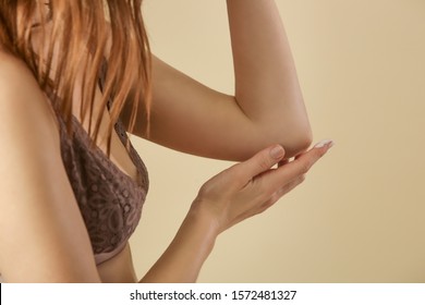 Woman Applying Cream On Her Elbow, Skin Care Concept, Eczema, Rosacea, Dry Skin Problem