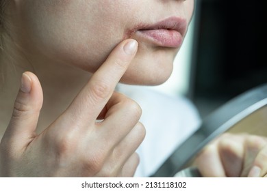 Woman Applying Lip Balm With Finger To Prevent Dryness And Chapping In Cold Winter Season, Looking At Mirror. Female Dry Lips Affected By Herpes, Suffering From Food Allergy, Infection Or Virus.