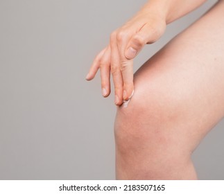 Woman Applying Ointment On Knee For Pain And Swelling Reduction. Leg Injury Treatment Concept. Bruise, Sprain, Arthritis, Overuse. Health Care Concept. High Quality Photo