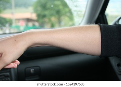 Woman Arm With Goose Bumps In A Car