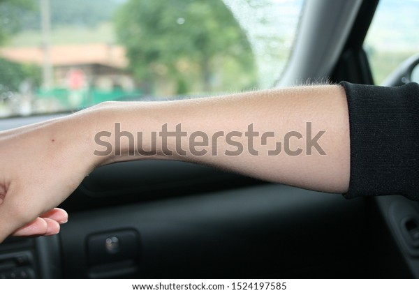 Woman arm with goose bumps\
in a car