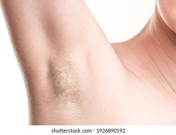 Woman with armpit hair, female hairy armpit, before shaving. Skinny girl on white background. Depilation cosmetic procedures. Beauty salon. Macro close-up skin.