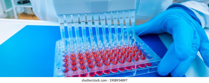 Woman Assistant In Laboratory With Multi Pipette In The Clinic, The Research Of Cancer Stem Cells