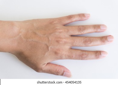 Woman Back Hand With Blood Veins.