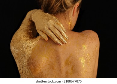 Woman With Back Pain. Skin Sare, Sunburn, Dry Skin Concept