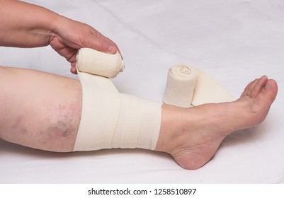 Woman Bandages Leg With Elastic Bandage Against Varicose Veins On Legs And Thrombosis, Close-up, White Background, Phlebeurysm, Medical, Trauma