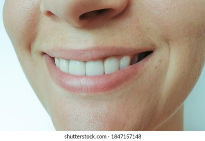 woman beautiful smile white teeth