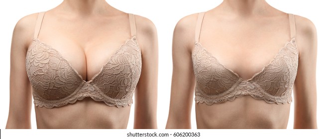 Woman before and after breast size correction on white background. Plastic surgery concept