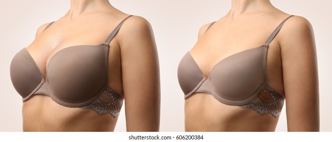 Woman before and after breast size correction on color background. Plastic surgery concept
