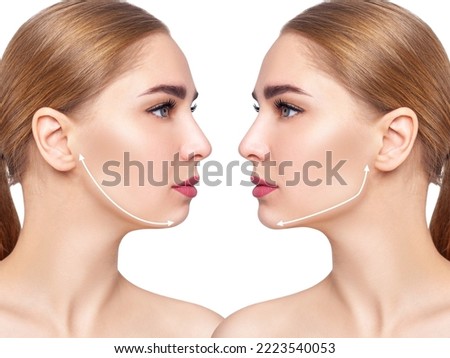 Woman before and after cheekbones shape correction. Isolated on white background.