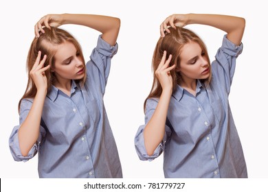 Woman Before And After Hair Loss Treatment On White Background.  -  Image  