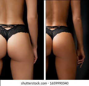 Woman Before After Instant Tan Spray Skintone Body.