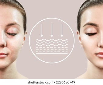 Woman before and after lifting skin. Infographic shows deep penetration of remedy in skin.
