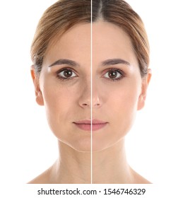 Woman before and after plastic surgery on white background